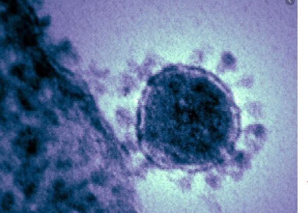 coronavirus-4-600x415.jpg